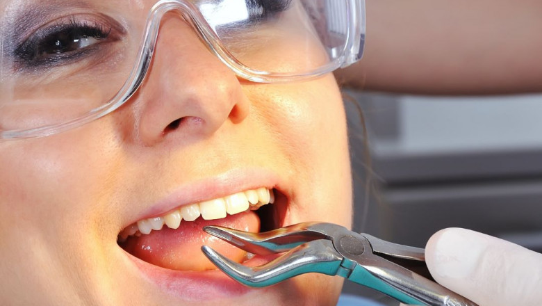 Advances in Minimally Invasive Tooth Extraction Techniques