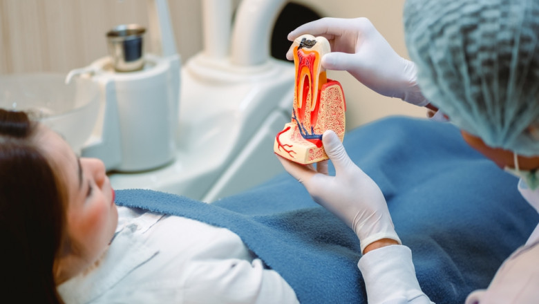 Saving Your Smile: What to Know About Root Canal Therapy