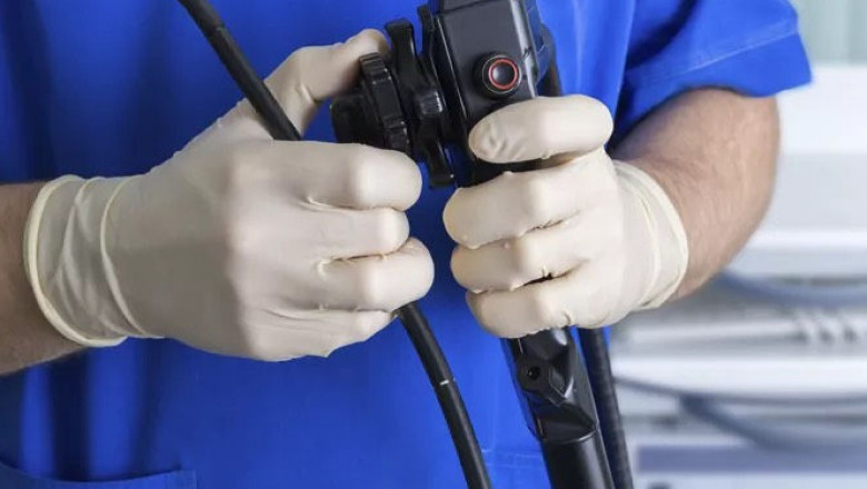 colonoscopy cost singapore