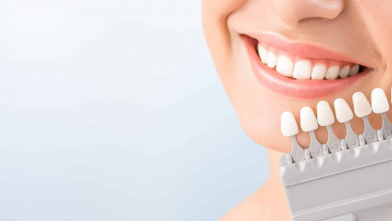 Possible Reasons for Opting for Cosmetic Dental Surgery