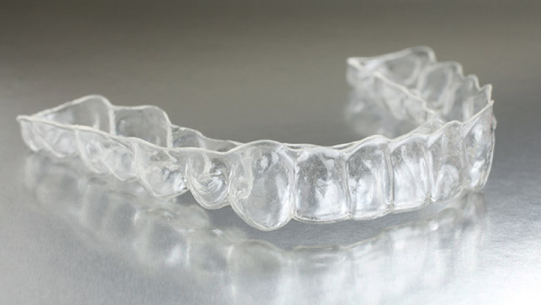 Top 5 Myths About Invisalign – Debunked by Ottawa's Reliable Dentists
