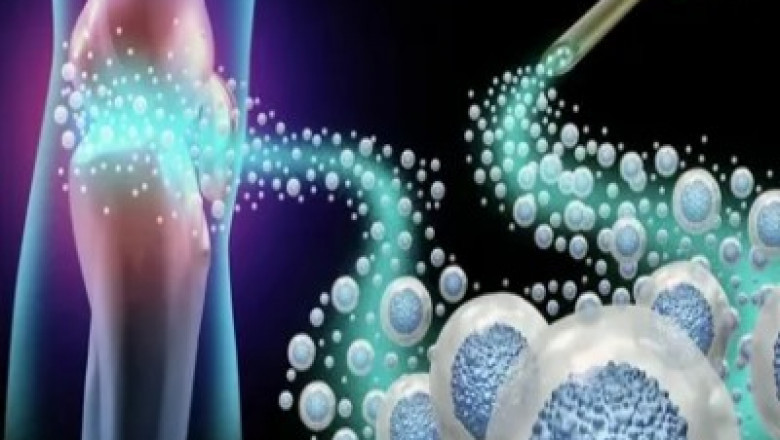 Everything You Need to Know About Mesenchymal Stem Cells and Their Therapeutic Potential