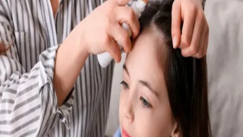 Lice Treatment Market Poised for Significant Growth Due to Advanced Topical Solutions