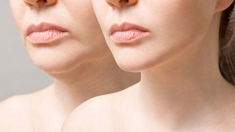 How do you keep your Botox results looking flawless under Hawaii’s sun?