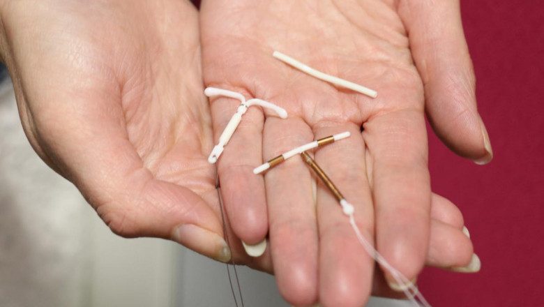 Understanding Sterilization: Tubal Ligation and Vasectomy Explained