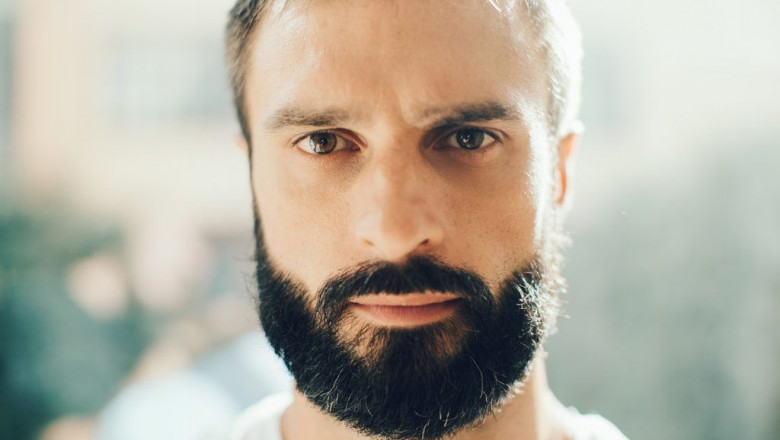 What You Need to Know About Beard Transplant Aftercare