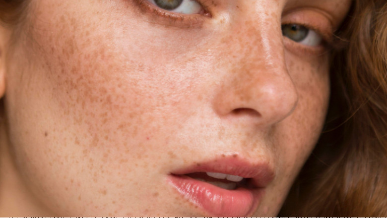 pigmentation treatments singapore