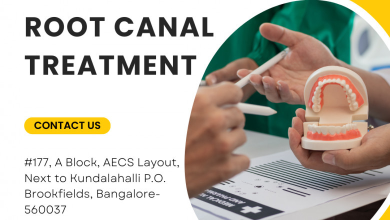 Best Root Canal Treatment in AECS Layout | Expert Dental Care