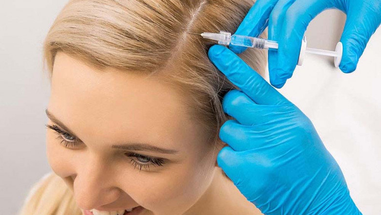 How Often Should You Get PRP Hair Treatments? Your Complete Guide