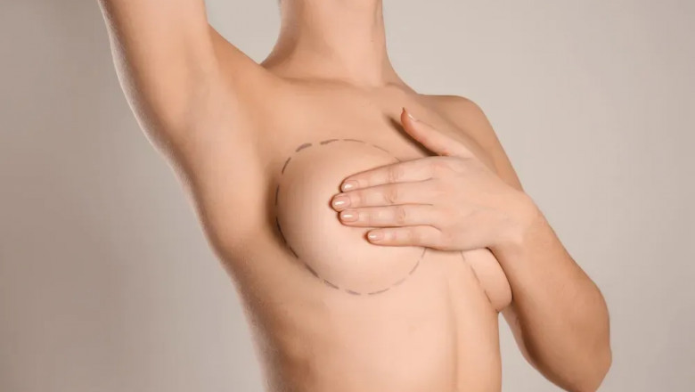 Breast Lift Surgery Recovery: What to Expect in the First Few Weeks
