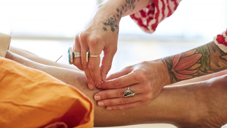 Natural Relief with Acupuncture for Health Philadelphia