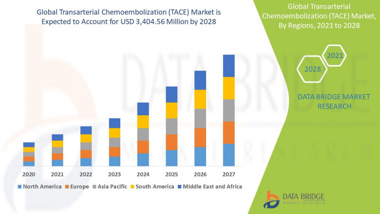 Transarterial Chemoembolization (TACE) Market Size, Analysis and Forecast