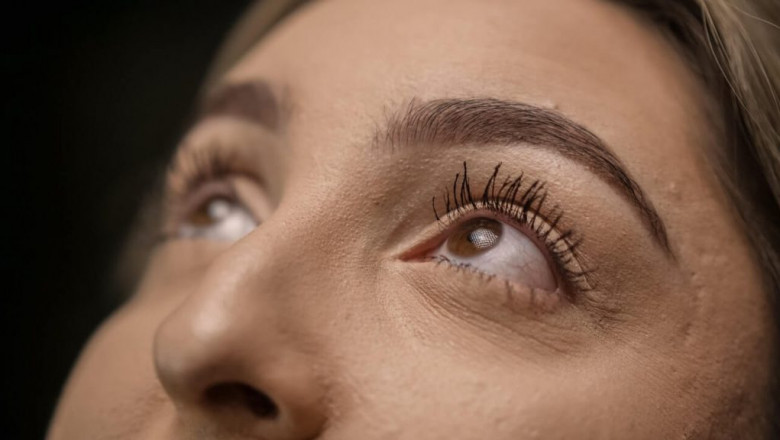 5 Things I Wish I Knew Before Getting an Eyelash Transplant