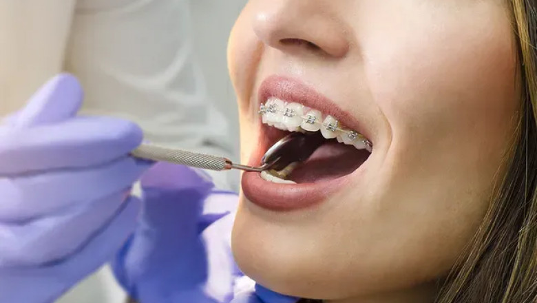 Beautiful Smiles Start Here | Amazing Smiles Orthodontics NYC