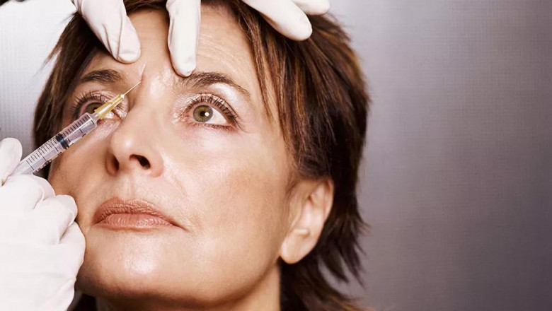 Botox for Migraine Management: Relief Beyond Wrinkles