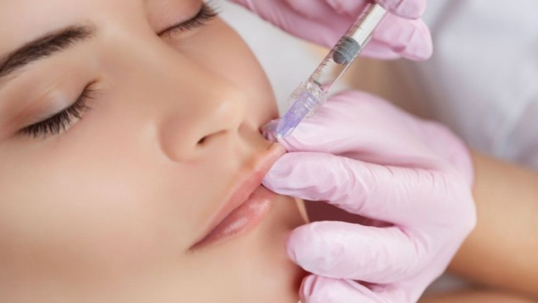 Russian Lip Fillers: A Safe Approach to Lip Enhancement?