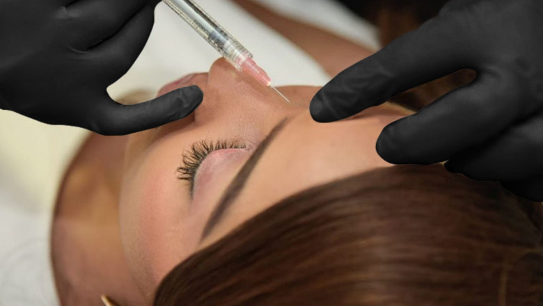 Brow Lift and Eyelid Surgery: Stunning Before-and-Afters
