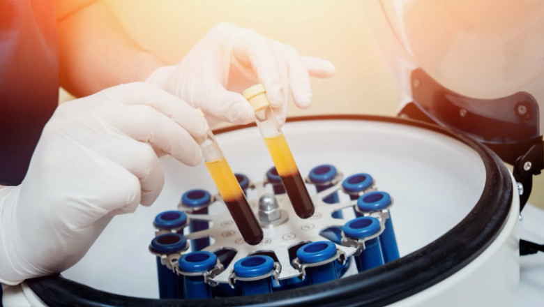 Plasma Fractionation Market to Grow at 7.8% CAGR Through 2031